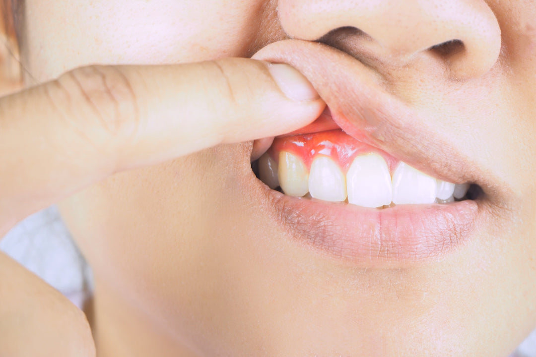 ORAL BLU LIGHT for GUM DISEASE